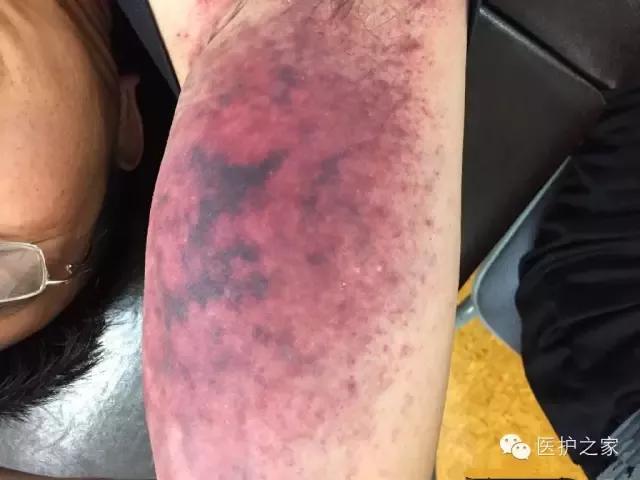 血淤 搜狐网