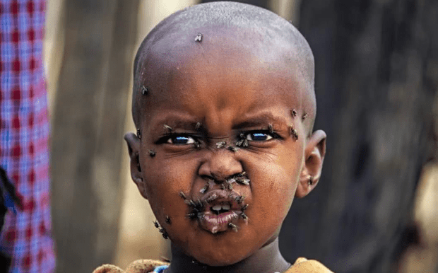 非洲小男孩身上爬满了苍蝇,眼神中透露着无奈,却对生活充满了渴望!