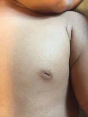  乳头　自我　中国 